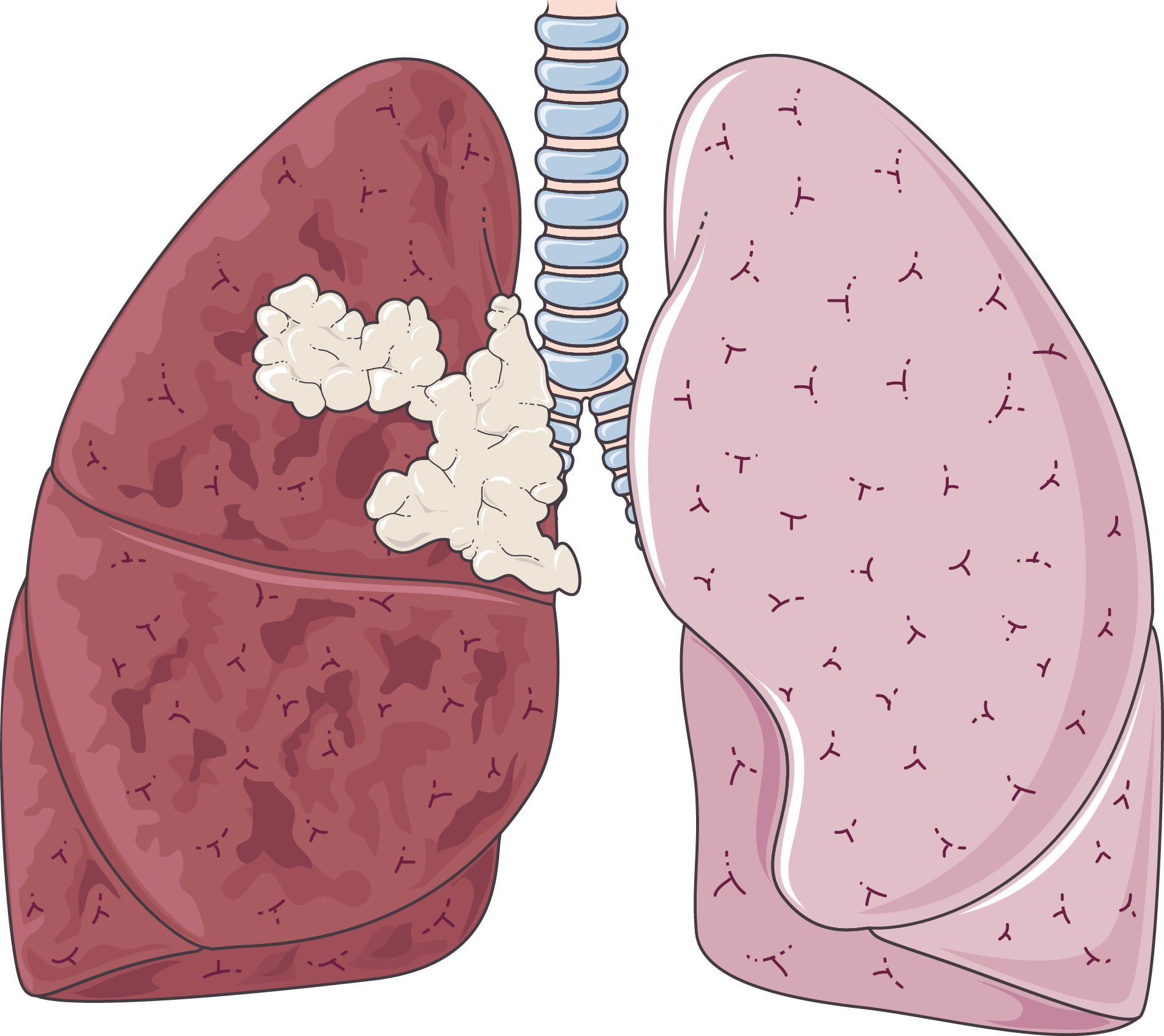 Lung Free PNG Clip Art