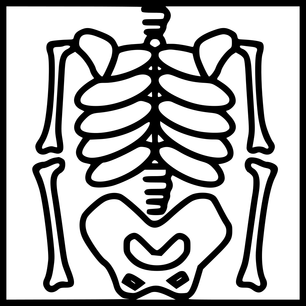 X-Ray PNG Photos
