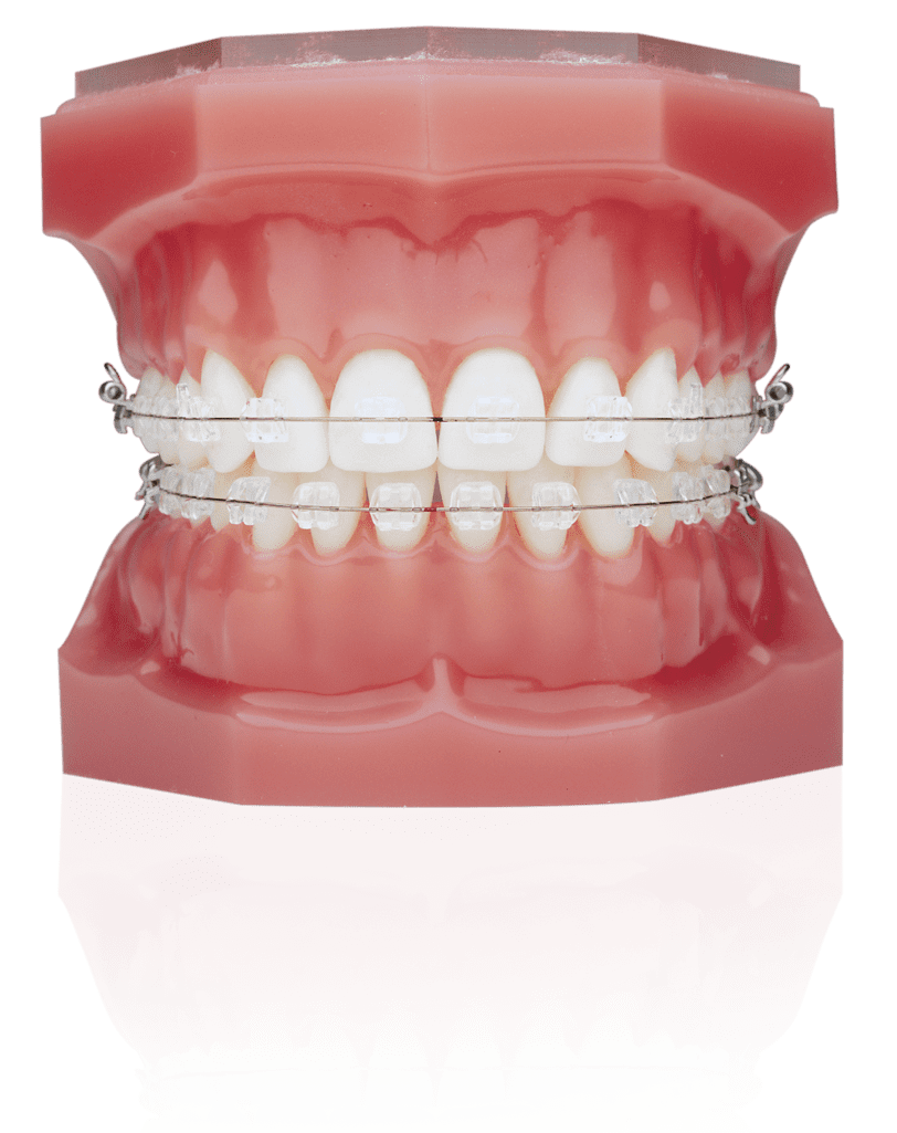 Braces Background PNG Image